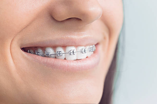 Best Veneers and Lumineers  in Elroy, WI